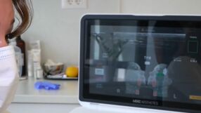 Абитуриенти отиват за корекции със снимки от интернет. За какво предупреждават естетичните дерматолози?