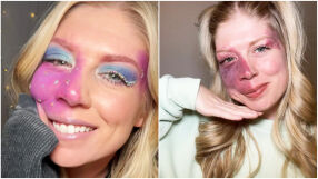 От подигравки до милиони последователи: Как едно момиче превърна родилния си белег в сила