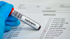 Случаи на заразени с лептоспироза на остров Закинтос, мъж е починал