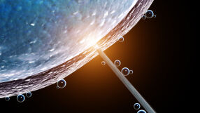 Откриване на „скрити сперматозоиди“: Нова технология дава надежда на мъже, считани за безплодни