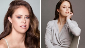 Гимнастичка със синдром на Даун разчупи модните стереотипи (ВИДЕО)