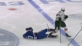 Хокеист остана без цял ред зъби след сблъсък с противник (СНИМКА)