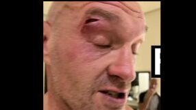 Тежка аркада и 15 шева: Отлагат Усик - Фюри