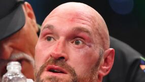 Боят на века: Хърватин разбил веждата на Фюри (ВИДЕО)