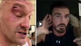 Разбили лицето на Тайсън Фюри заради глупава шега (ВИДЕО)