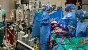 Пациент оцеля 48 часа без бели дробове в подготовка за трансплантация