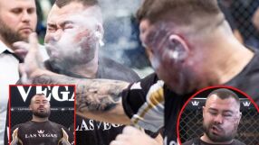 Шампионът по биене на шамари - като нападнат от рояк бесни оси (ВИДЕО)