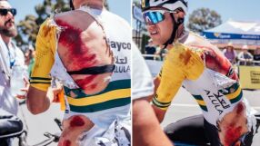 Това боли: Целият в кръв и без кожа