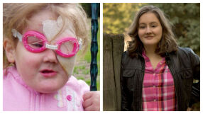 Какво е да живееш, без да изпитваш никаква болка – историята на Габи Гинграс