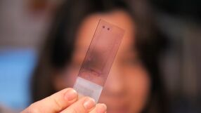 Има ли „лечебна“ диета при лупус?: Проучване на млад учен от БАН