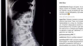 Цветелина Стоянова показа рентгенова снимка на гръбнака си