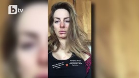 Сани Жекова с извадено рамо и ожулено лице (ВИДЕО)
