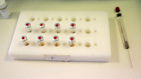 Разследват над 21 атлети за кръвен допинг