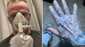 Събудих се като герой от „Аватар“: Паника в спешно отделение заради синята кожа на мъж 