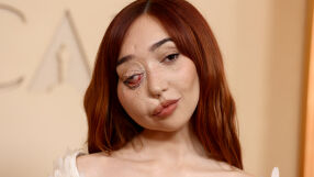 Модел с рядко медицинско състояние дефилира на 