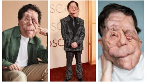 Адам Пиърсън: актьорът, който превърна различието си в сила и стигна до Оскарите