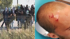 21 души в ареста за нападение срещу играчи на 