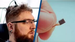 Имплантираха чипове в мозъка на хора, страдащи от слепота, глухота и депресия