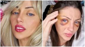 31-годишна жена почина след 27 пластични операции - искала да бъде Барби (СНИМКИ)