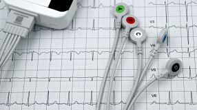 Защо случаите на инфаркт и инсулт се увеличават между Коледа и Нова година?