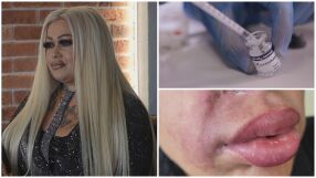 Дилъри на ботокс: Незаконна и опасна козметика от Азия залива българския пазар