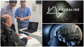 „Управлява компютър с мисълта си часове след операцията“: Имплантите на Мъск вече са в Европа