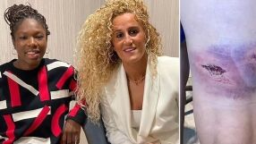 Футбол и омраза: Счупете ѝ коляното!