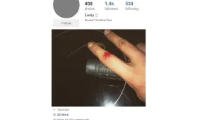 17-годишна вкара съученичка в болницата в Стара Загора и се похвали със снимка
