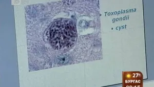 Бременните жени трябва да се изследват за токсоплазмоза