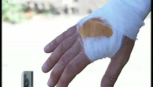 Цветарка нападна и ухапа инспектор