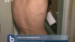 Полицейско насилие: Момчета се оплакват от побой в РПУ