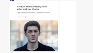 Опозиционен журналист е ранен тежко при нападение в Москва