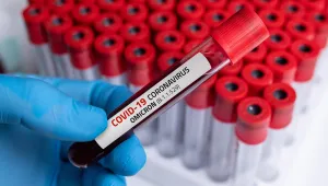 704 нови случая на COVID-19 у нас