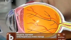 Перде на окото се лекува почти напълно с операция