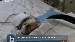 Хирурзи разделиха успешно сиамски близначки