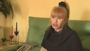 Жената-каучук днес е в плен на патерици 