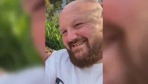 „Разядено“ от киселина: Мъж губи зрението на едното си око, докато спасява сина си