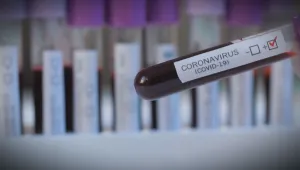 Традиционно нисък брой нови случаи на COVID-19 в неделя – 227