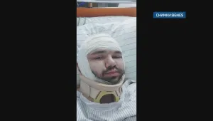 Пребитият в Охрид българин е изведен от реанимация