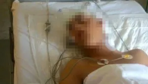 Повдигнаха обвинение на 17-годишен младеж, опитал да убие свой връстник в Китен