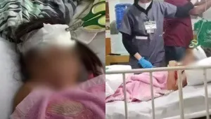 Момиченце остана седмица със забита ножица в главата, родителите му не можели да платят на лекарите
