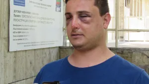 Пребиха мъж с прътове заради забележка