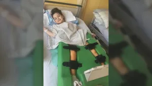 Все още няма решение по казуса с лечението на 6-годишната Анелия