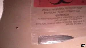 Мъж живее три години с нож, забит в гърба, без да знае