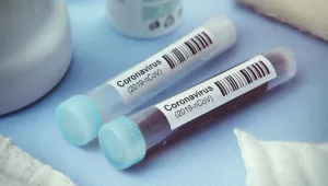 Двама туристи от Израел са с COVID-19 след ски ваканция у нас