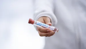 619 са новите случаи на COVID-19 в страната 