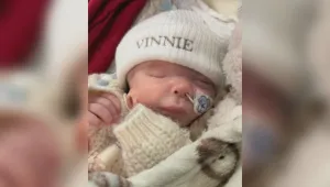 Бебе се ражда с ухо върху лицето си