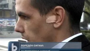 Младеж твърди, че полицаи го били по време на разпит