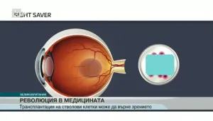 Присадиха на пациентка стволови клетки, надяват се пак да прогледне 