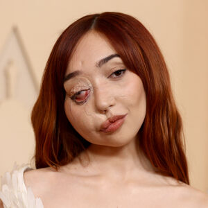 Модел с рядко медицинско състояние дефилира на "Оскарите" в зашеметяваща рокля (СНИМКИ)